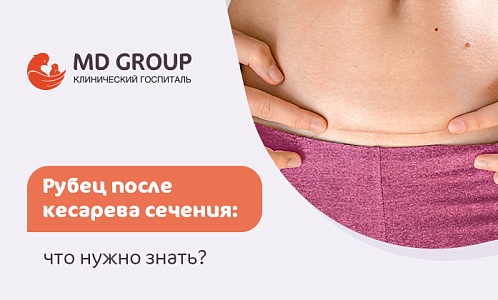 Рубец после кесарева сечения: что нужно знать?